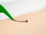 TickCheck Premium Tick Remover Kit
